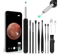 Otoscopio, Pulisci Orecchie Con Telecamera, 1296P HD Orecchie Pulizia Orecchie R