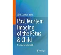 Owen Arthurs Post Mortem Imaging of the Fetus & Child (Copertina rigida)