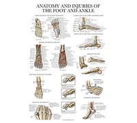 Palace Learning Anatomia laminata e lesioni del piede e della caviglia Poster - Tabella anatomica delle articolazioni del piede e della caviglia - 45,7 x 68,6 cm