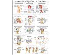 Palace Learning Poster laminato con anatomia e lesioni del ginocchio, tabella anatomica dell'articolazione del ginocchio, 45,7 x 61 cm