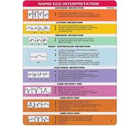 Panoramica sulla conoscenza dell'ECG, cartelli in metallo, guida all'interpretazione dell'ECG per poster di assistenza primaria, guida di riferimento per ufficio, decorazione da parete per casa, clini