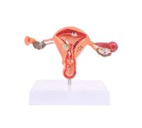Pathological Uterus Ovary Anatomical Model Anatomy for Cross Section Study Tool