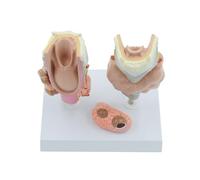 Patologia tiroidea Modello di anatomia laringea Insegnamento Patologia tiroidea Scuola di medicina Insegnamento