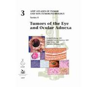 Patricia Chévez-Barrios Amy Y. Lin Tatyana Tumors of the Eye (Copertina rigida)