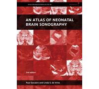 Paul Govaert Linda S. de V An Atlas of Neonatal Brain Sonogr (Copertina rigida)