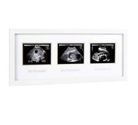 Pearhead Triple Sonogram - Cornice per gravidanza, per scansione del bambino, annuncio di gravidanza, colore: bianco