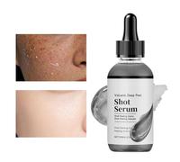 Peeling Viso | Idratante per la Pelle 100ml - Soluzione Nutriente per il Viso - per Donne Mamme Ragazze Amanti della Bellezza Viaggiatori e Professionisti Ideale per la Routine Quotidiana