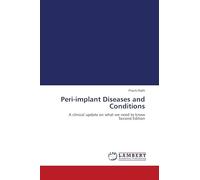 Peri-implant Diseases and Conditions: A clinical update on what we need to know Second Edition