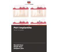 Péri-implantite: Percer le mystère