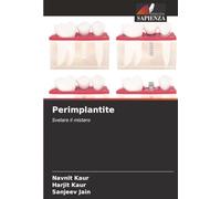 Perimplantite: Svelare il mistero