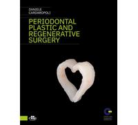 Periodontal plastic and regenerative surgery - Cardaropoli Daniele