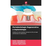 Periodontologia Regenerativa e Implantologia: Andaimes de nanocompósitos impressos em 3D com dupla administração de medicamentos