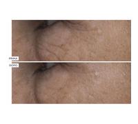 Perricone MD Cold Plasma Plus+ Crema viso (59ml) e occhi (15ml)