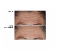 Perricone MD Siero nutriente High Potency Hyaluronic (2 pz)