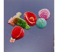 Peter Gabriel - New Blood: Live In London