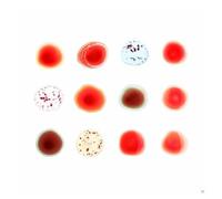Peter Gabriel Scratch My Back/And I'll Scratch Yours (Vinyl LP) 12" Album