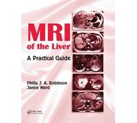Philip J. A. Robinson Janice Ward MRI of the Liver (Tascabile)