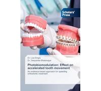 Photobiomodulation: Effect on accelerated tooth movement: An evidence-based approach for speeding orthodontic treatment