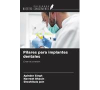Pilares para implantes dentales: Crear la conexión