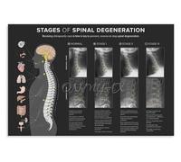 PIUHRKLEVD Detailed Spinal Anatomy Chart Educational Poster Human Backbone Diagram Canvas Art Print Vintage Style Wall Decor for Office Library (8 X 12 in)