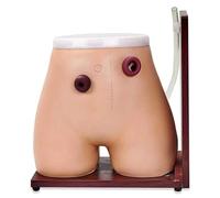 PODEC Modello Infermieristico Avanzato per Fistola Ostomia, Modello di Assistenza Medica per Fistola Ostomia, Modello di Formazione Pratica per Colostomia E Ileostomia, per La Formazione Medica