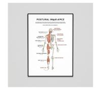 Poor Posture Effects Poster Chiropractic Educational Wall-Art for Spinal Alignment Health Clinic Hospital Office Decor Canvas Print(Framed,12x18inch(30x45cm))