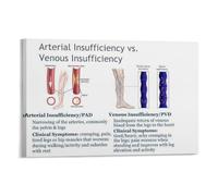 poster Anatomy Poster: Understanding Varicose Veins - Medical Infographic with Clear Illustrations - Knowledgeable Decor for Home Office, Study, Living Room(Unframed,08x12inch(20x30cm))