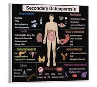 poster Understanding Bone Density Poster - Osteoporosis Factors & Health Chart, Informative Decor for Doctor's Office(Unframed,16x24inch(40x60cm))