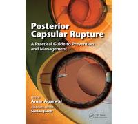 Posterior Capsular Rupture: A Practical Guide to Prevention and Management