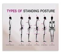 PQYSMVVG Posture Related Back Conditions Chart Standing Position Errors Poster Health Awareness Wall-Art Print(Framed,16x24inch(40x60cm))