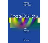 Practical ECG Holter: 100 Cases