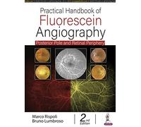 Practical Handbook of Fluorescein Angiography: Posterior Pole and Retinal Periphery