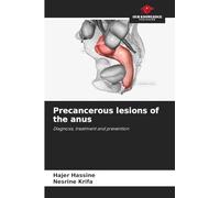 Precancerous lesions of the anus: Diagnosis, treatment and prevention