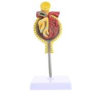PRETYZOOM Modello Anatomico Glomerulo Renale in Pvc con Base per Insegnamento Medico e Display Realistico per Aula Didattica e Studio Scientifico