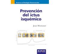 Prevención del ictus isquémico