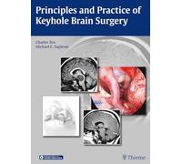 Principles and Practice of Keyhole Brain Surgery