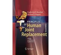 Principles of Human Joint Replacement: Design and Clinical Application