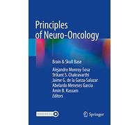 Principles of Neuro-oncology: Brain & Skull Base