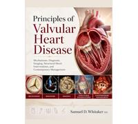 Principles of Valvular Heart Disease: Mechanisms, Diagnosis, Imaging, Structural Heart Interventions, and Contemporary Management