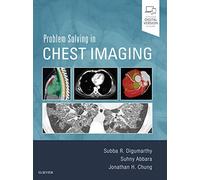 Problem Solving in Chest Imaging – Elsevier