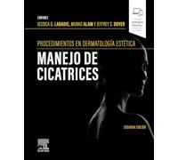 Procedimientos en dermatología cosmética: manejo de cicatrices