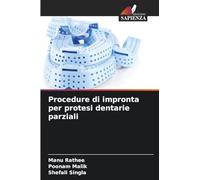 Procedure di impronta per protesi dentarie parziali