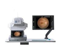 Produttore di apparecchiature oftalmiche for la fundus camera, fotocamera digitale for oculare non midriatica for oftalmologia
