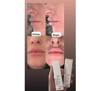 PROMO FESTA DELLA MAMMA LIPLIFT 3.0 - Balsamo labbra ad effetto filler