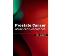Prostate Cancer: Advanced Researches (Copertina rigida)