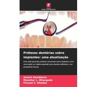 Próteses dentárias sobre implantes: uma atualização: Uma visão geral das próteses removíveis sobre implantes como uma opção em rápida expansão para doentes edêntulos, com perspetivas futuras