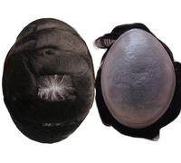 Protesi capelli pellicola impianto parrucchino invisibile uomo toupet 002