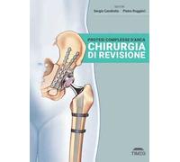 Protesi complesse d'anca. Chirurgia di revisione. Ediz. illustrata