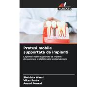 Protesi mobile supportata da impianti: La protesi mobile supportata da impianti: - Rivoluzionare la stabilità delle protesi dentarie