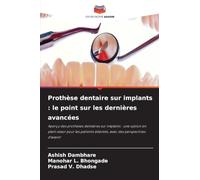 Prothèse dentaire sur implants : le point sur les dernières avancées: Aperçu des prothèses dentaires sur implants : une option en plein essor pour les patients édentés, avec des perspectives d'avenir